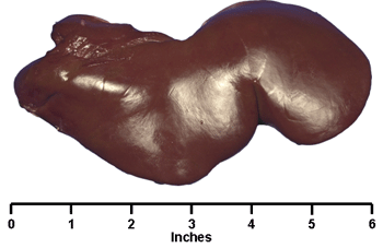 Liver