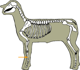 Metacarpals