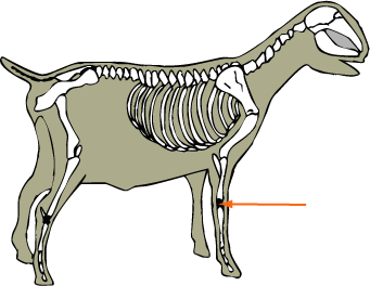 Carpal Bones
