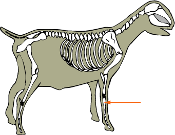 Metacarpals