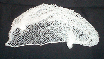 Ham Net