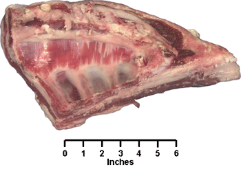 Breast