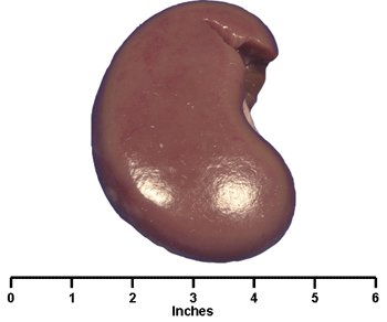 Kidney