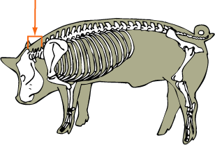 Cervical Vertebrae