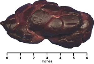 Kidney