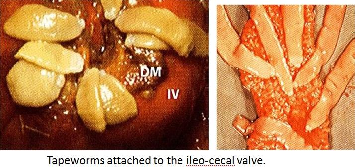 Cestodes or Tapeworms